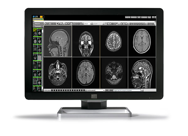 2D Viewer Features